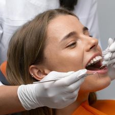 Types of Cavity Fillings: How to Choose the Best One for Your Teeth